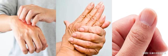 指南：从成分党视角解锁「手护」密码九游会·j9网站杜馥尔夏末秋初护手(图3)